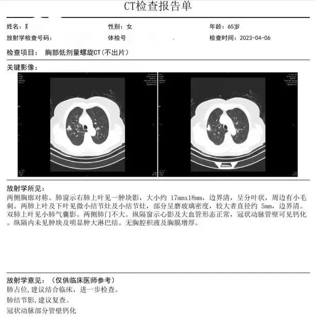 同花顺客户端显示异常电脑端同花顺怎么登录国泰君安账户